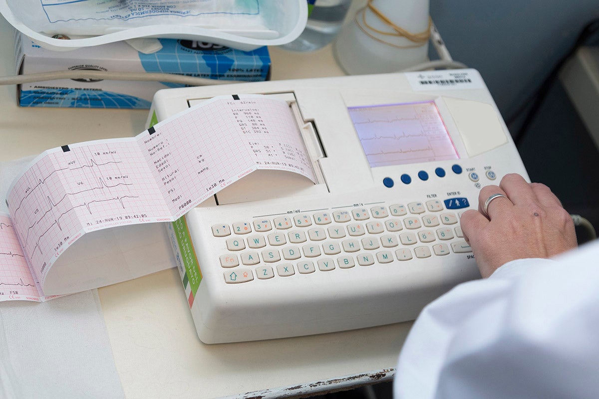 electrocardiograma
